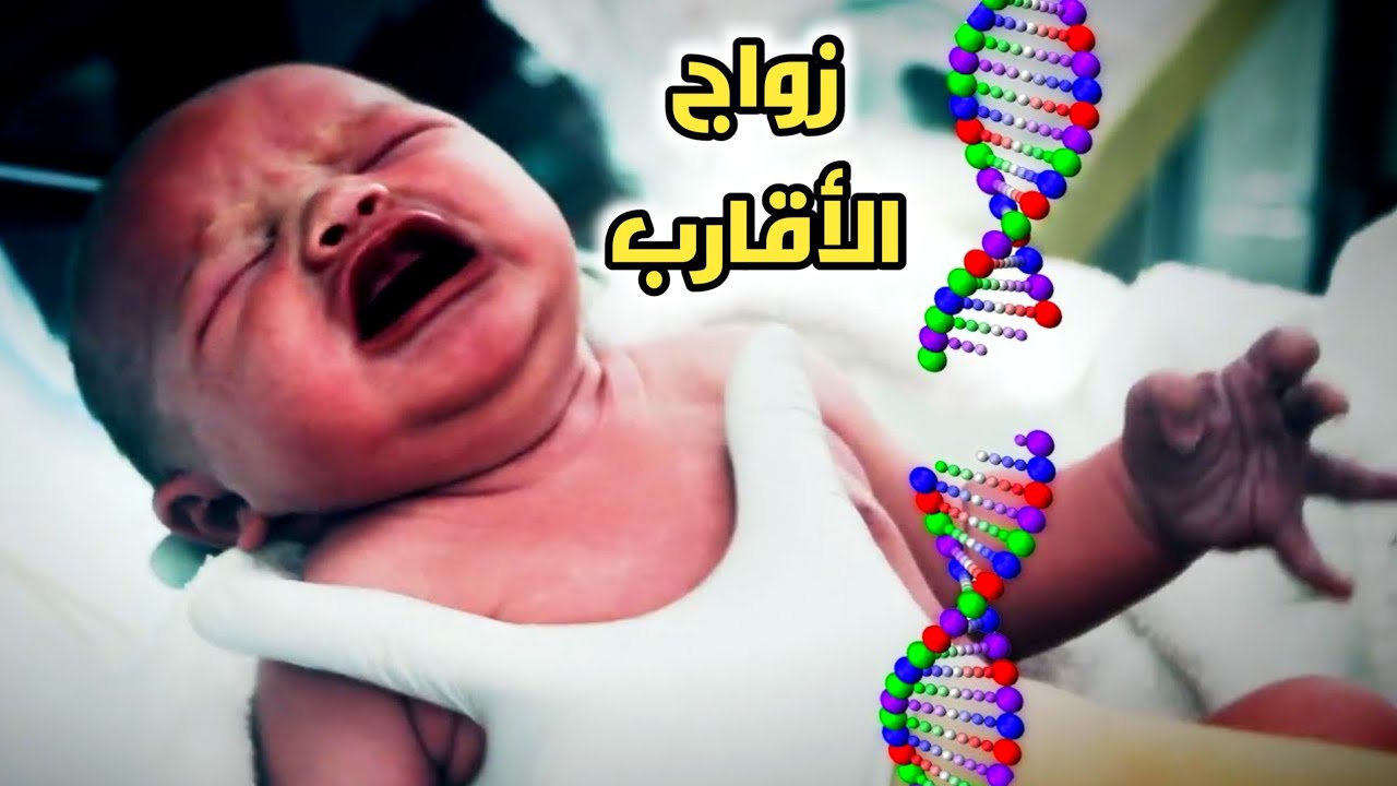 هل زواج الأقارب ممكن ينتج عنه أطفال مشوهة؟_ Consanguineous marriage and genetic diseases