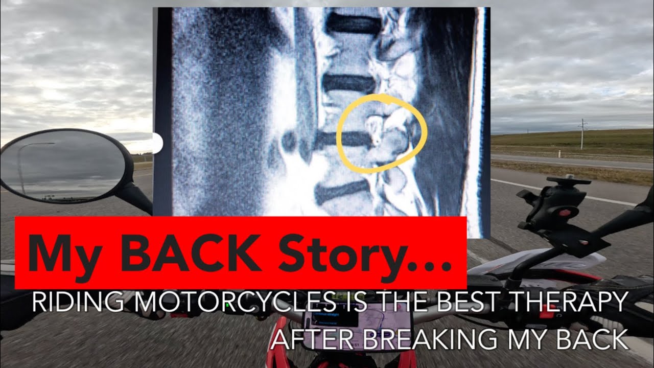 Моя история о спине — езда на мотоцикле после перелома спины 🩻