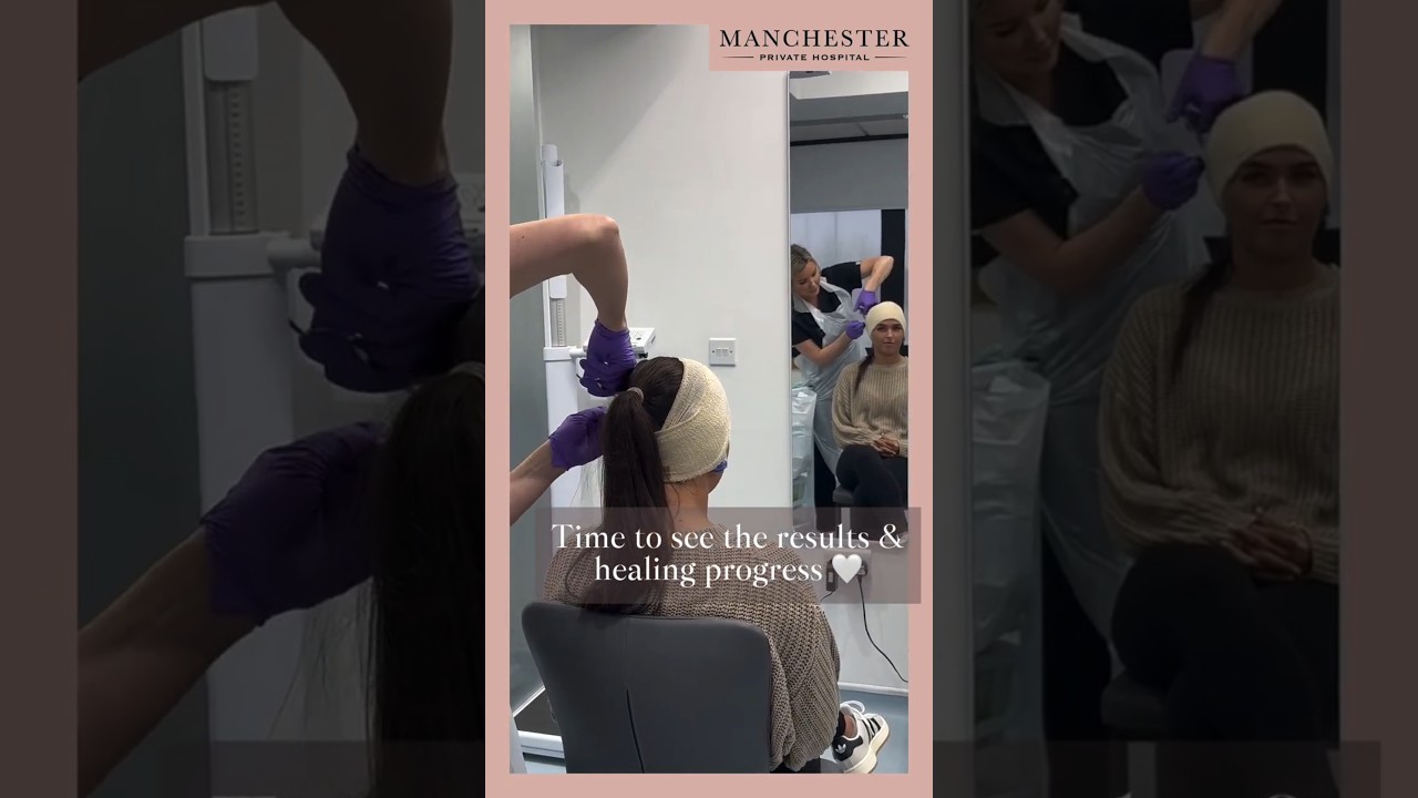 Otoplasty Experience: 1 Week Post-Op Update with Our Patient’s Journey