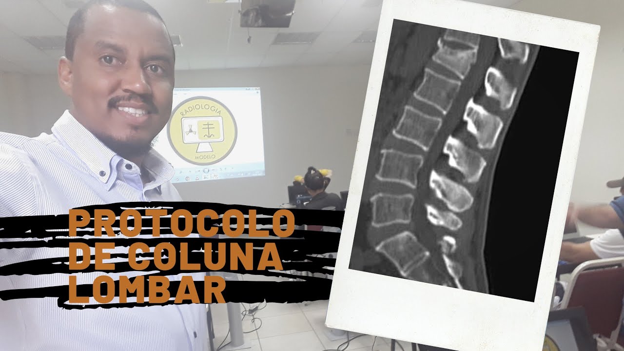 PROTOCOLO DE COLUNA LOMBAR - DIEGO CESAR