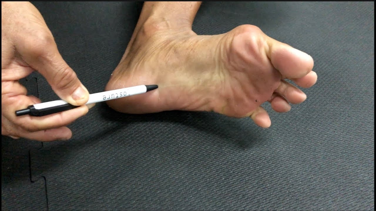 3 СОВЕТА по исправлению плоскостопия 👣 | Posturepro