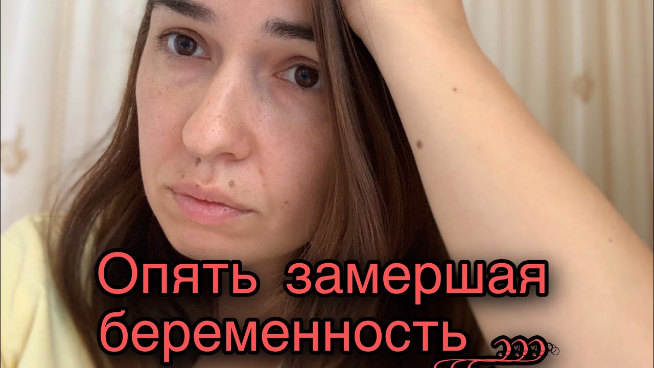 Две замерших беременности подряд, мой низкий рост хгч