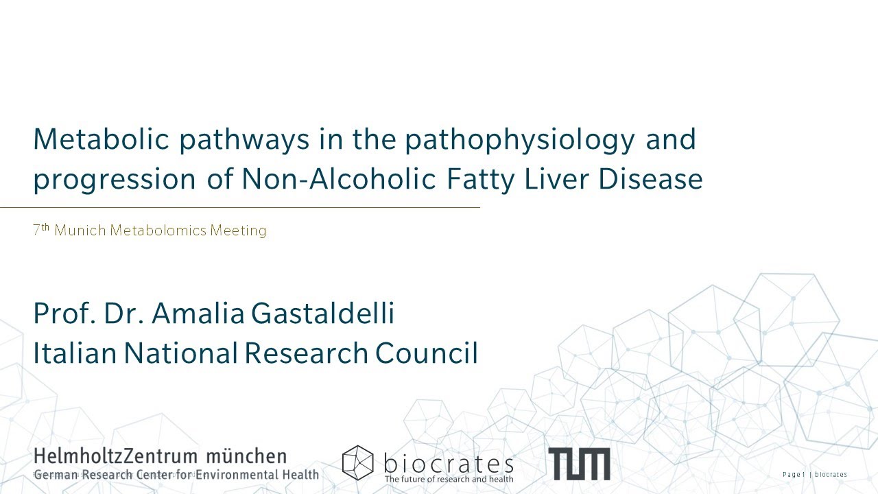 Metabolic pathways in the pathophysiology and progression of Non-Alcoholic Fatty Liver Disease
