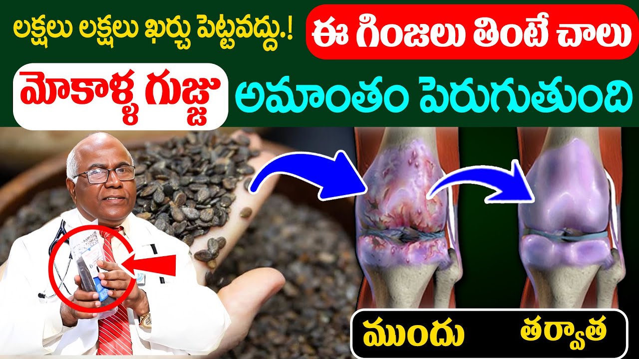 మోకాళ్ళ నొప్పి పోయి లేచి పరుగెడుతారు | Knee Pain Relief | Dr CL Venkat Rao | iD Health Podcast