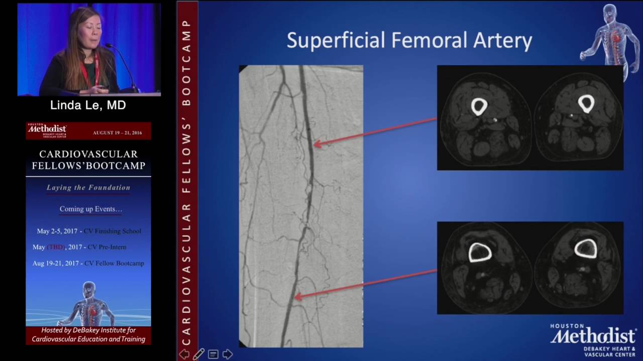 Lower Extremity Anatomy (Linda Le, MD) Saturday, August 20, 2016