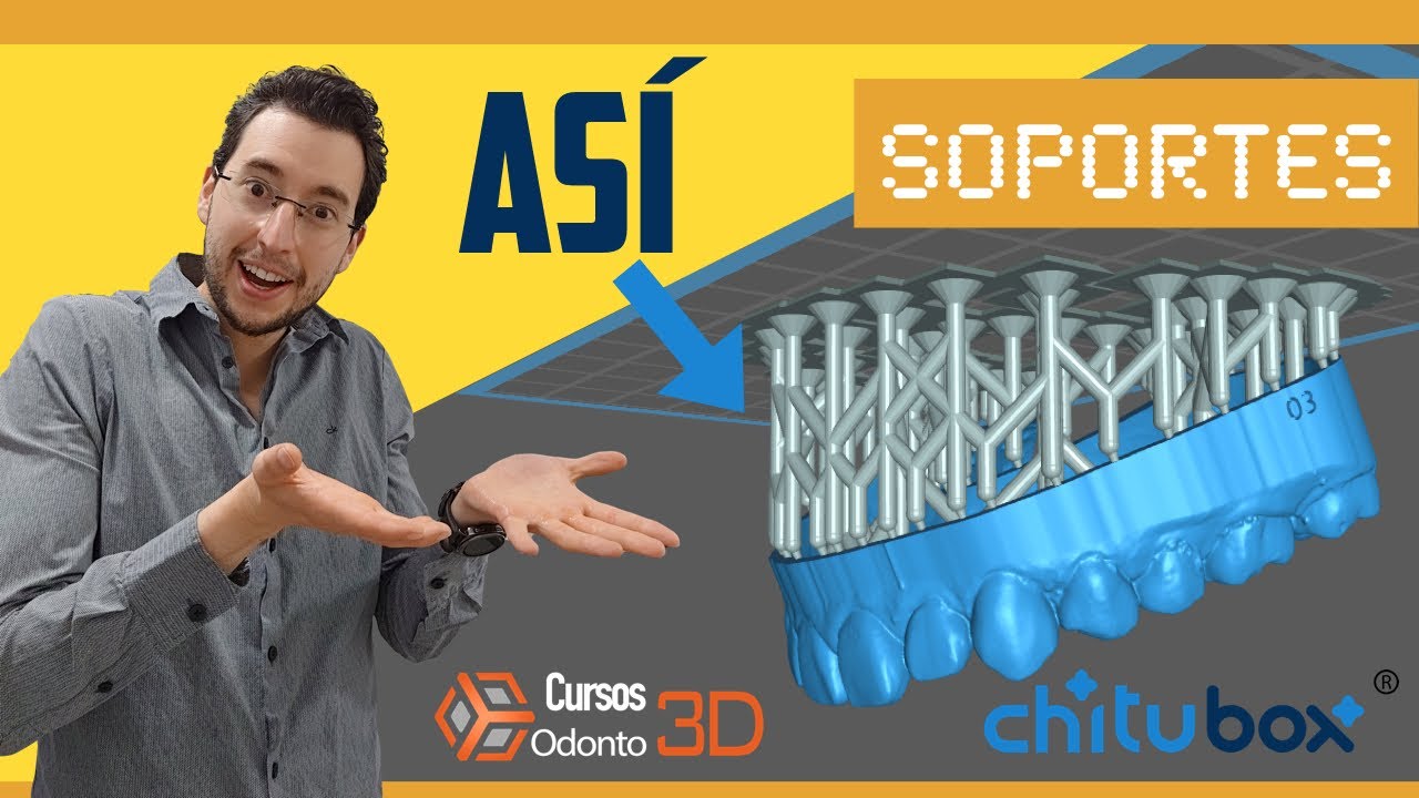 Guía definitiva y simplificada de soportes en Chitubox | Impresión 3D de resina en Español.