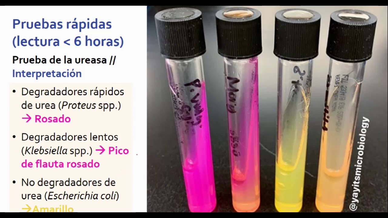 Pruebas Bioquímicas II:  Coagulasa | Ureasa | Indol