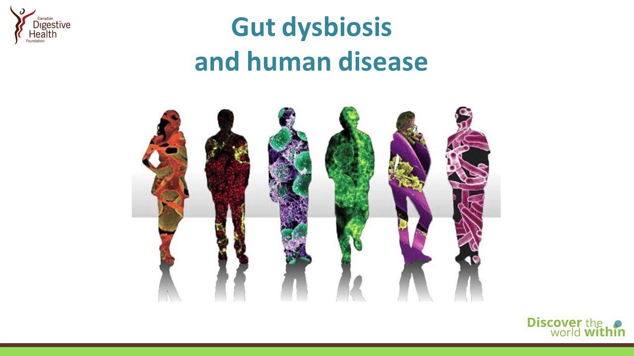 Introducing the Human Gut Microbiota