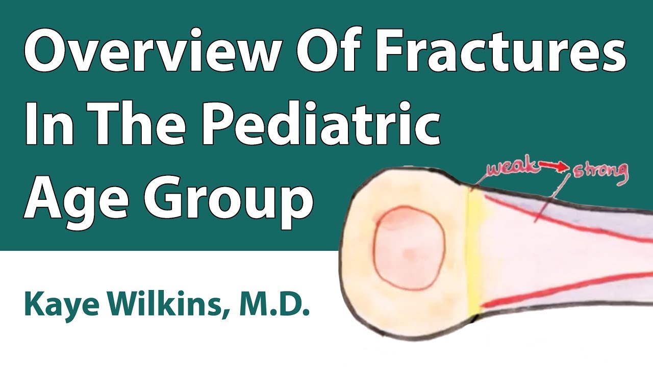 Overview Of Fractures In The Pediatric Age Group