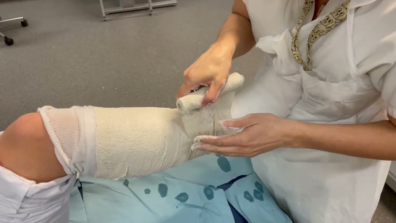 Tuto Gypso' - Botte circulaire plâtrée