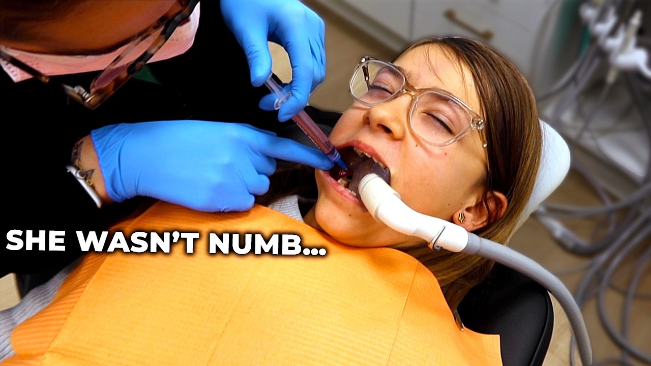 Wizyta u dentysty poszła nie tak&hellip; Nie była całkowicie zdrętwiała 😬