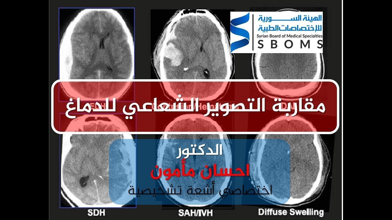 مقاربة التصوير الطبقي للدماغ  || approach to brain CT