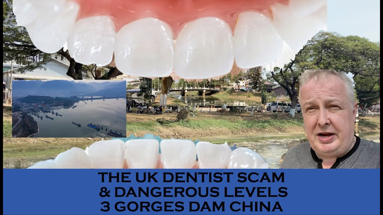 THE UK DENTIST SCAM ​& DANGEROUS LEVELS 3 GORGES DAM CHINA