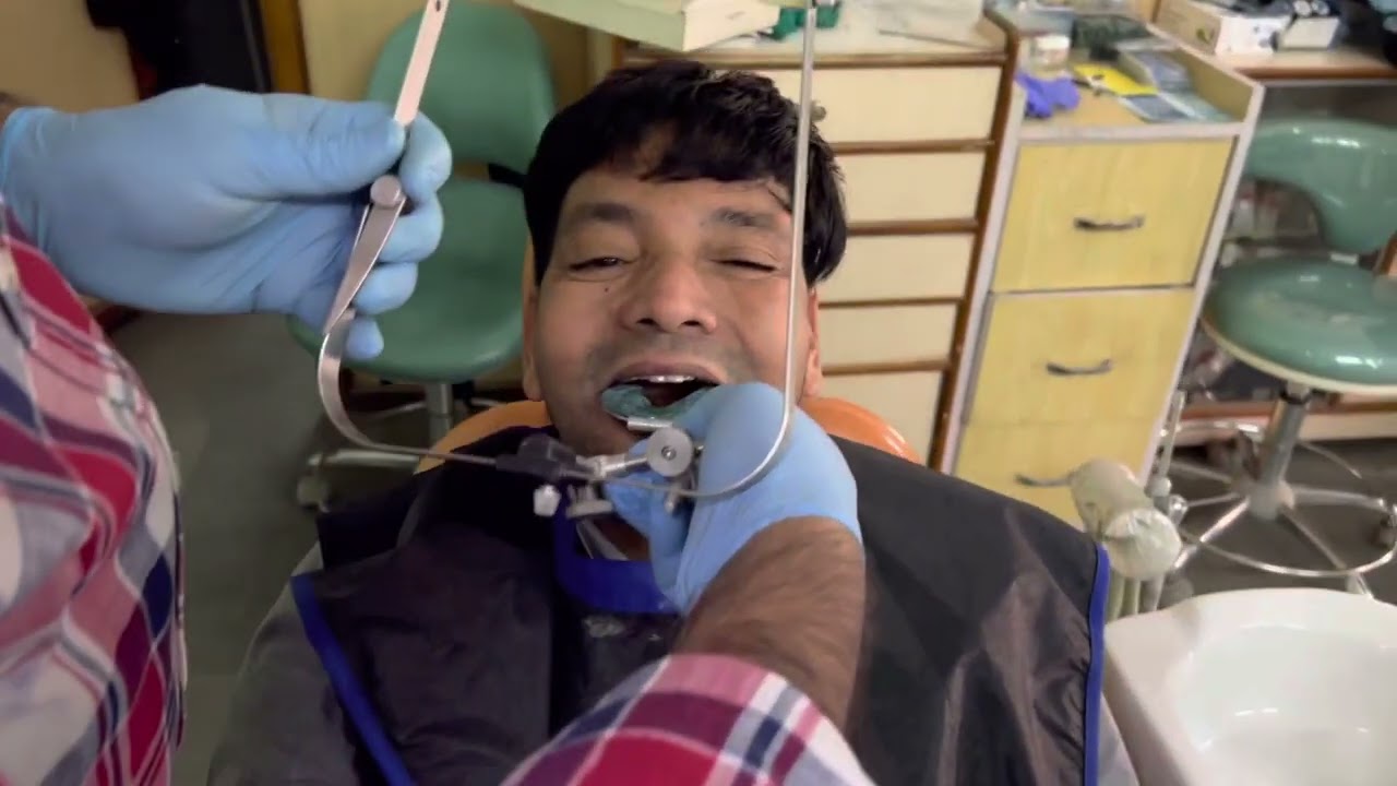 How to do face bow transfer in patient who needs full mouth rehabilitation with fixed teeth