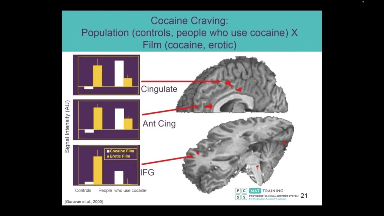Module 1 Overview of Substance Use Disorder