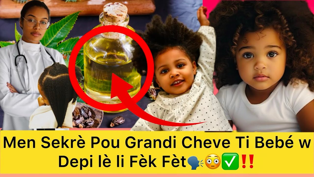 Men 5 Lwil Kap Ede Cheve Bebé w La Pouse Byen Vit 🗣️Bebé devan tèt Chankre ,dèyè tèt kale 👇🏾‼️😳✅