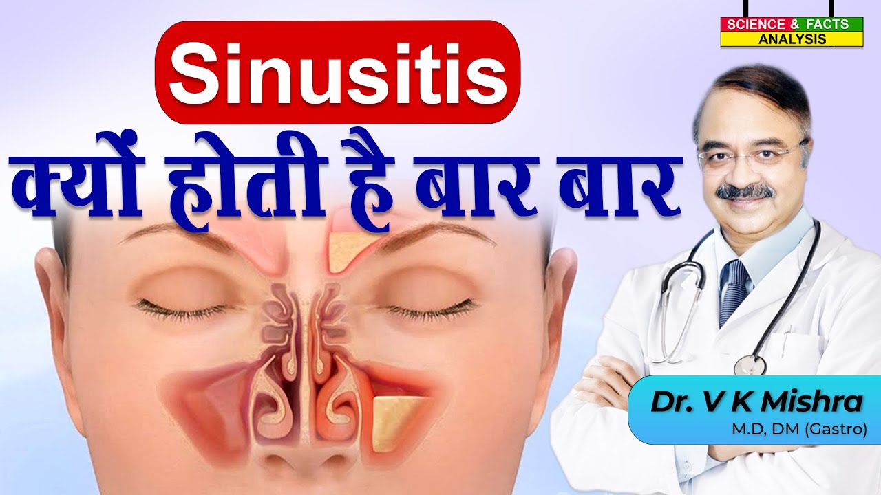Sinusitis क्यों होती है बार बार  || SINUS HEADACHE CAUSES, RISK FACTORS AND COMPLICATINS