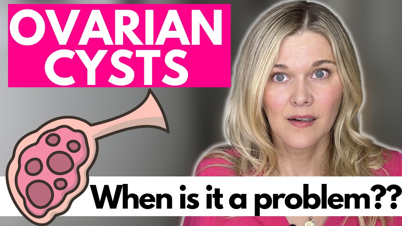Ovarian Cysts: What Is A Functional Cyst? What Is Normal? When Is An Ovarian Cyst A Problem?
