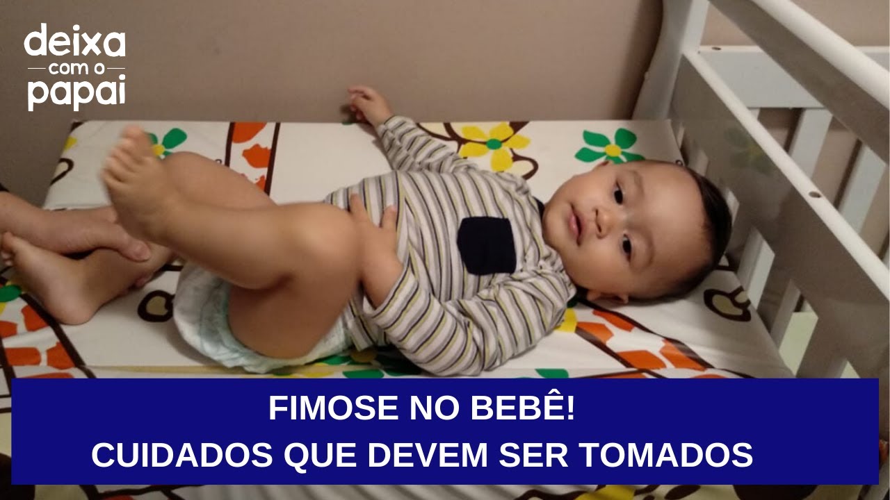 FIMOSE NO BEB&Ecirc; : COMO CUIDAR E SABER SE &Eacute; FISIOL&Oacute;GICA/DEIXA COM O PAPAI