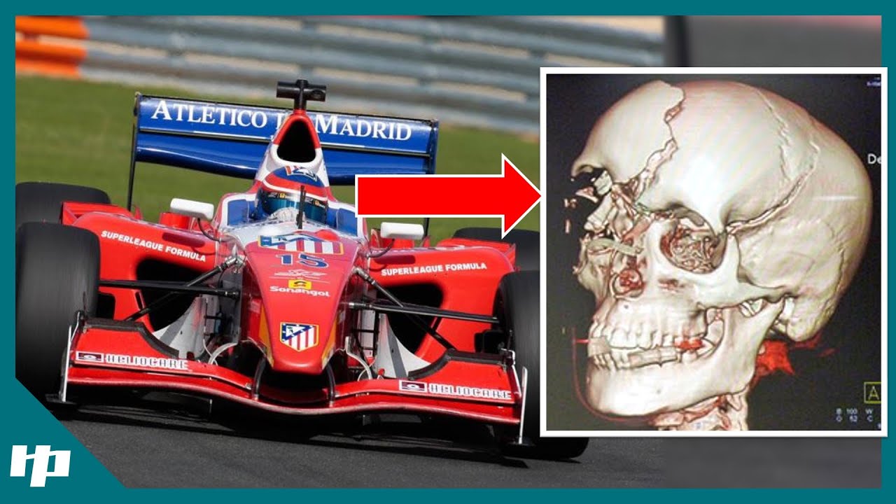 【ゆっくり解説】F1ドライバーのありえない亡くなり方