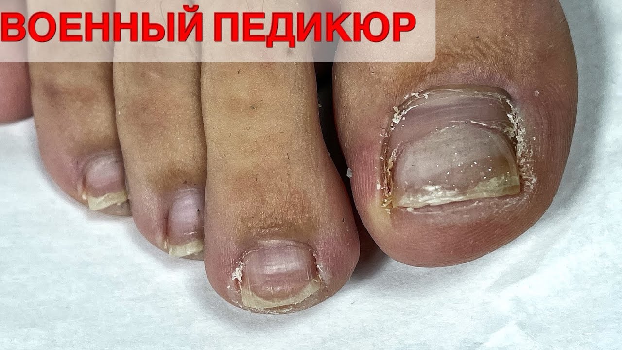 ПЕДИКЮР ОНЛАЙН. Виктория Авдеева