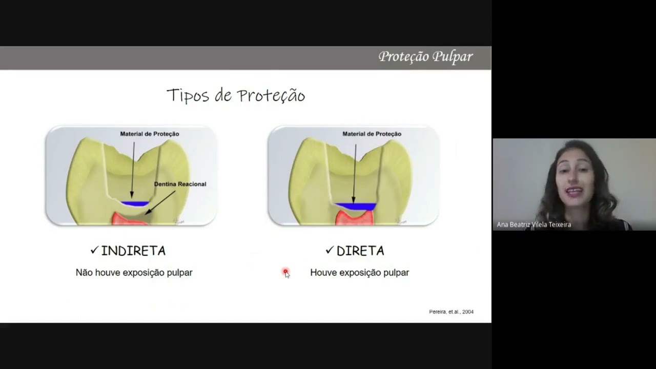Prote&ccedil;&atilde;o Pulpar - Cimento Ion&ocirc;mero de Vidro - Parte 1