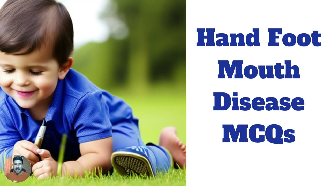 Hand Foot Mouth Disease MCQs with Rationale - Test Your Knowledge