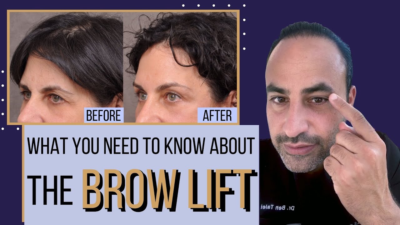 What You Need To Know About The Brow Lift | Dr. Ben Talei Beverly Hills, Los Angeles