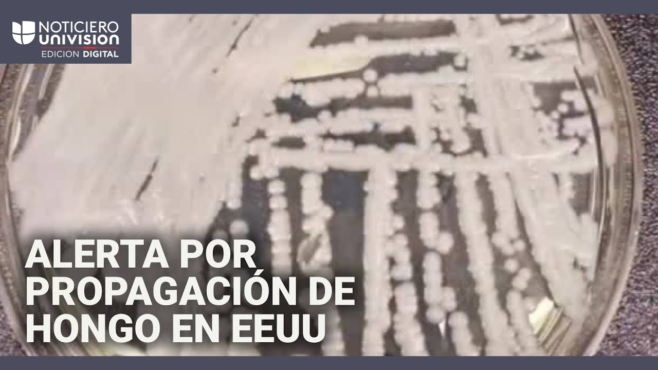 Un hongo mortal y resistente a medicamentos se propaga con rapidez en EEUU: hay 27 estados afectados