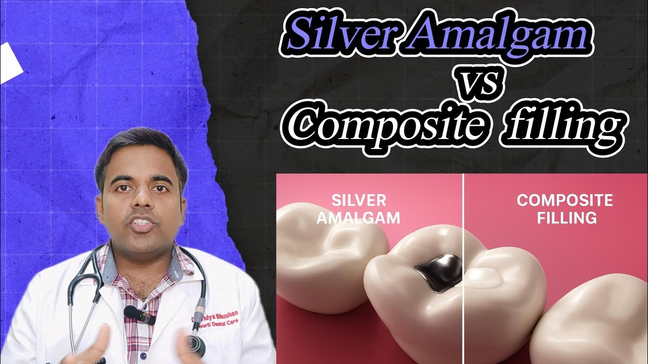Silver Amalgam vs Composite Filling | Best Dental Filling Option Explained by Dr. Vidya Bhushan