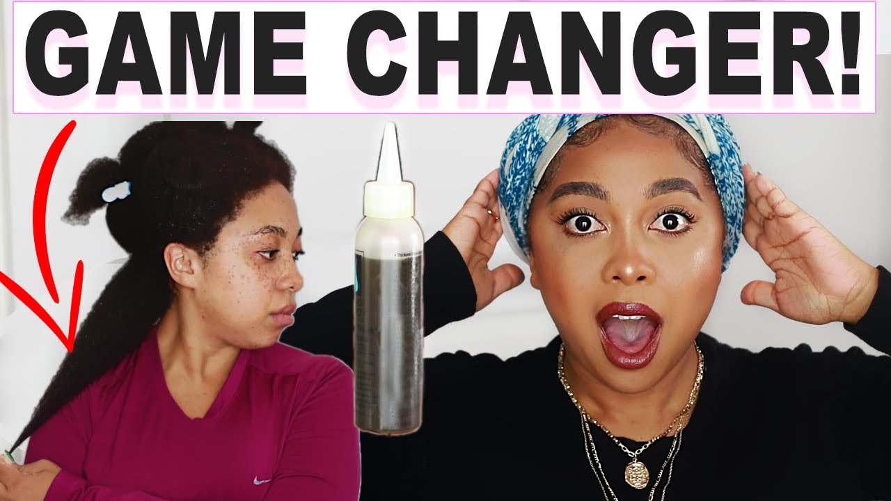 DO NOT WASH IT OUT! USE THIS DIY EXTREME HAIR GROWTH OIL TWICE A WEEK FOR MASSIVE HAIR GROWTH (2021)