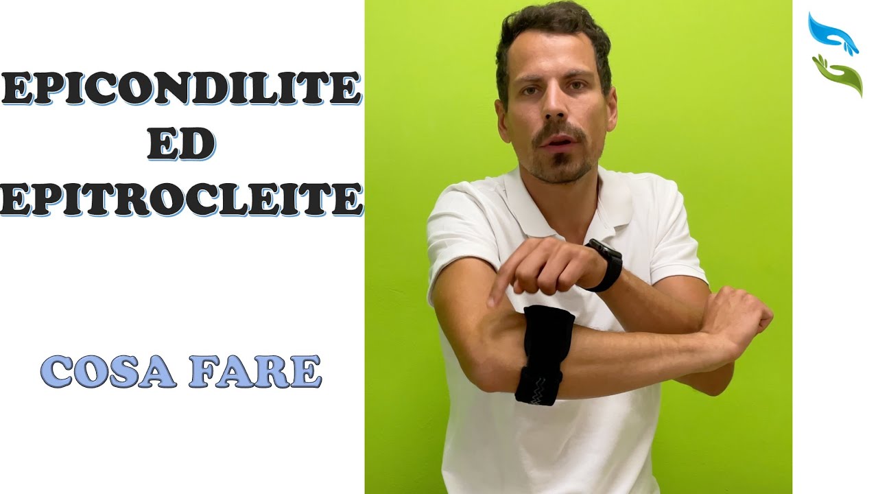 EPICONDILITE, EPITROCLEITE. Cosa fare (esercizi e tutori).