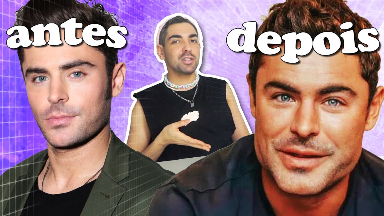 FAMOSOS ANTES E DEPOIS DAS PLÁSTICAS 2 (a demonização facial tem que acabar)