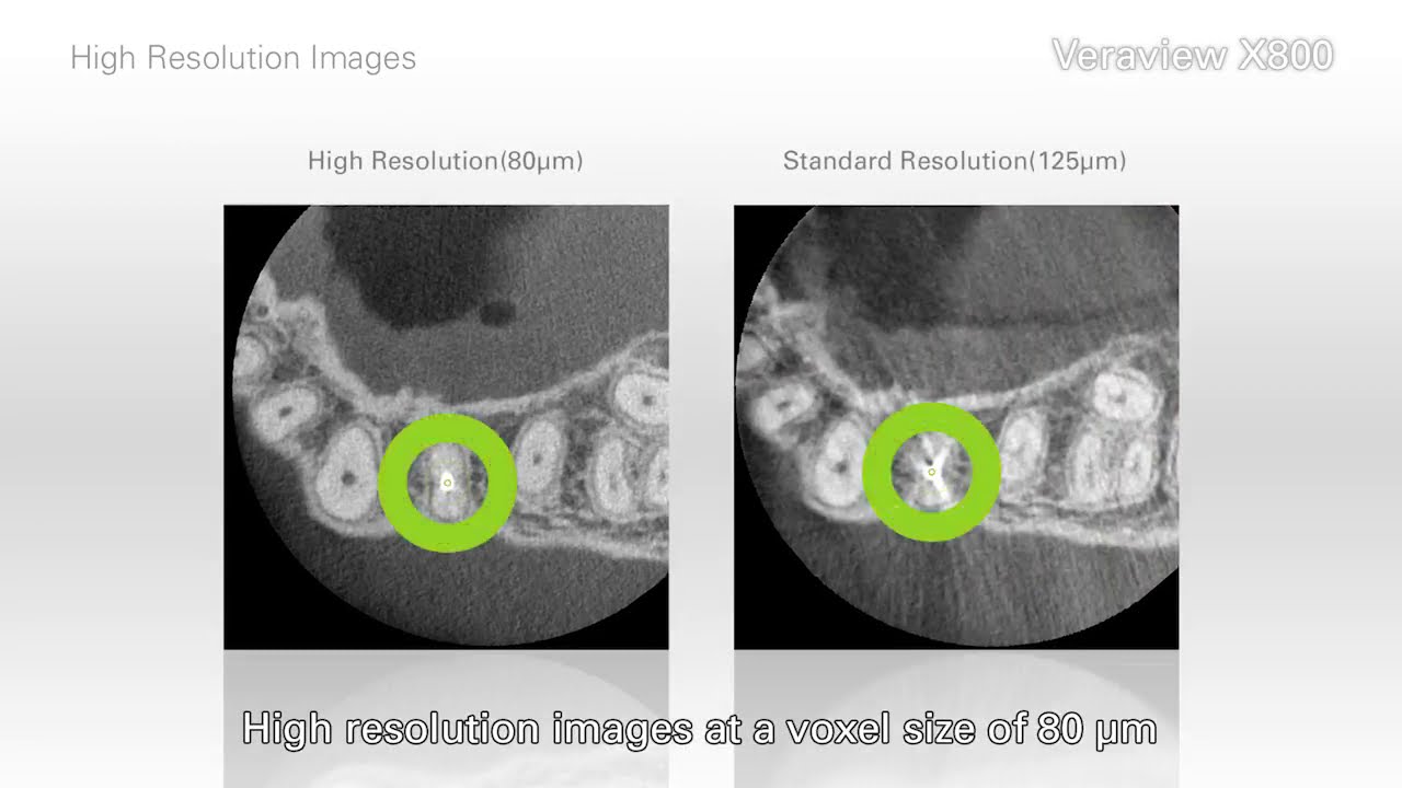 Morita Veraview X800 - Alta Resolução