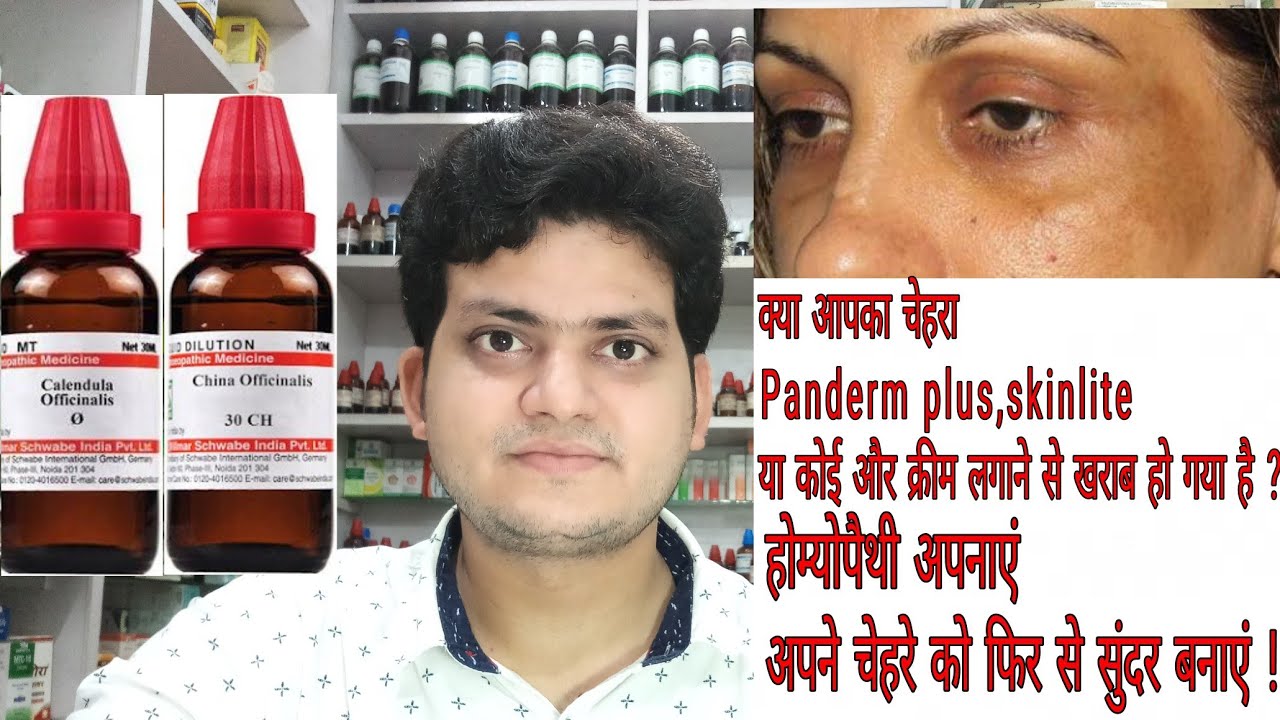 Homeopathic medicine for Bad effect on face of panderm skinlite and other creams ?