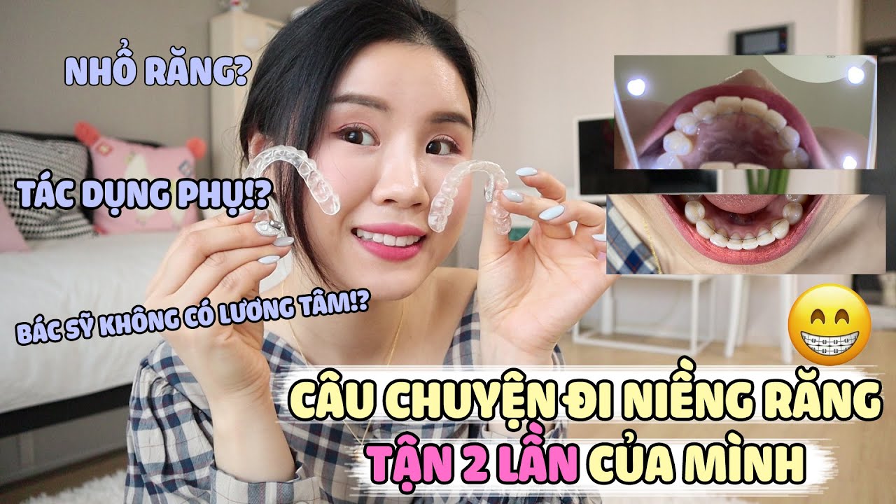 🦷🤭CÂU CHUYỆN ĐI NIỀNG RĂNG TẬN 2 LẦN CỦA MÌNH