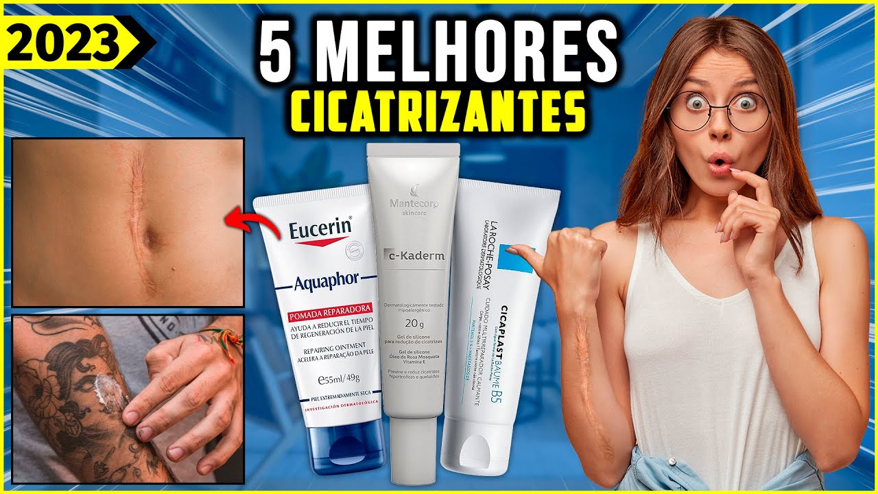 As 5 Melhores Pomada Cicatrizante/Pomada para Queloide De 2023!