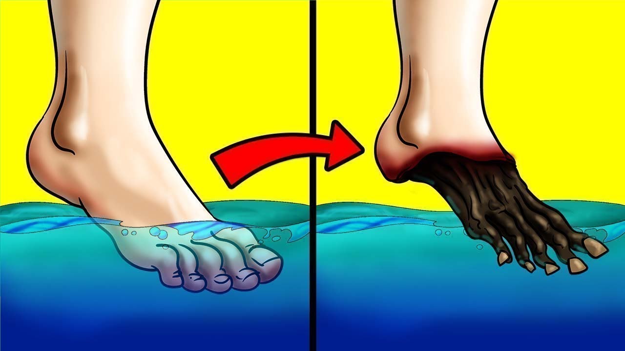 Você Não Sobreviveria Se Mergulhasse o Dedão Do Pé Neste Lago