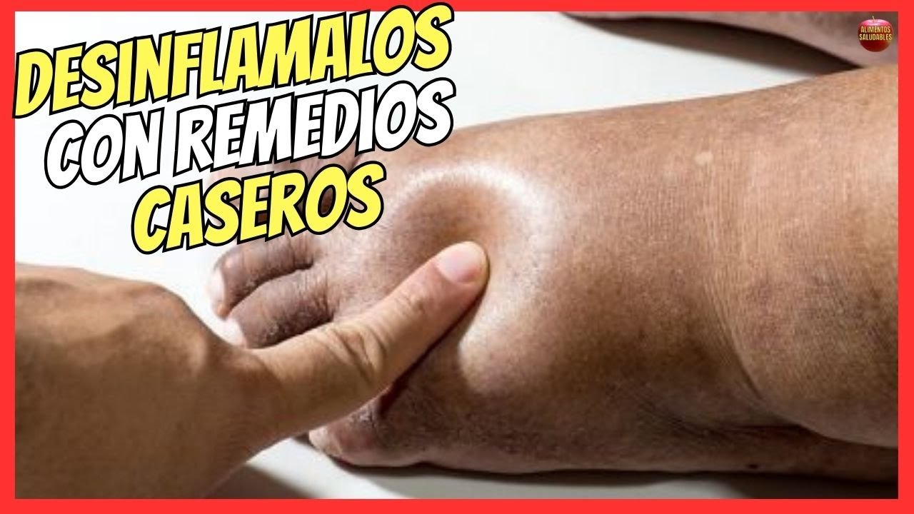 🔴 &iquest;COMO DESINFLAMAR LOS PIES HINCHADOS CON REMEDIOS CASEROS? 🔥