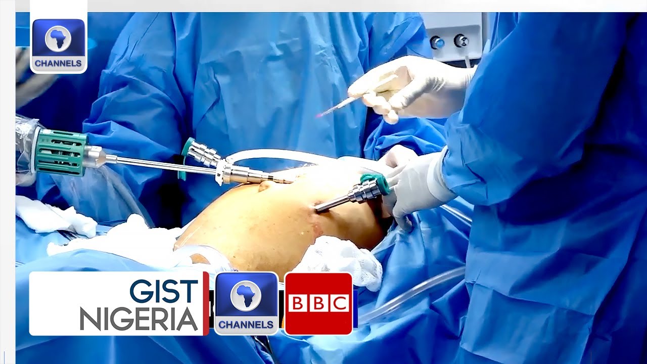 Robotic Revolution: Nigerian Doctor Pioneers Prostate Cancer Surgery In West Africa | Gist Nigeria