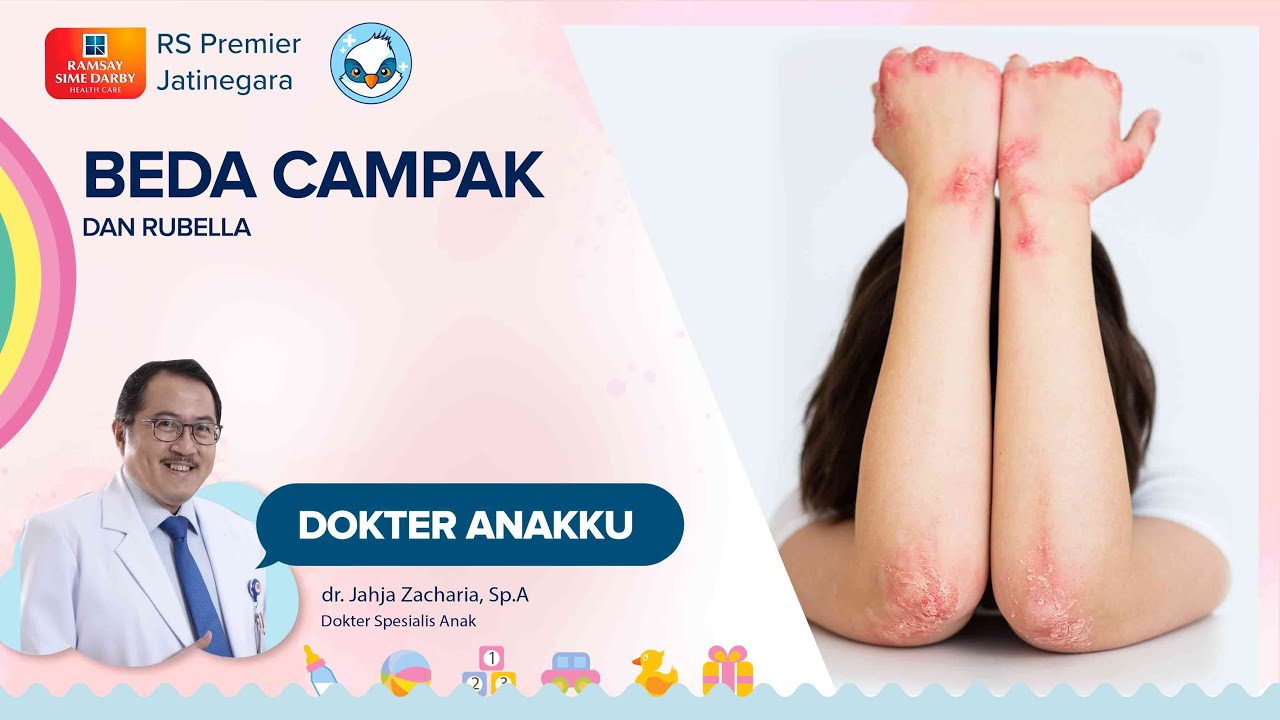 PENYAKIT CAMPAK JERMAN (RUBELLA)  BAHAYA BAGI SIAPA? - DOKTER ANAKKU DOKTER JAHJA