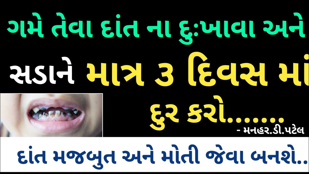 ગમે તેવા દાંત ના દુખાવા અને સડા ને માત્ર 3દિવસ માં દ્દુર કરો ||, Manhar.D.Patel