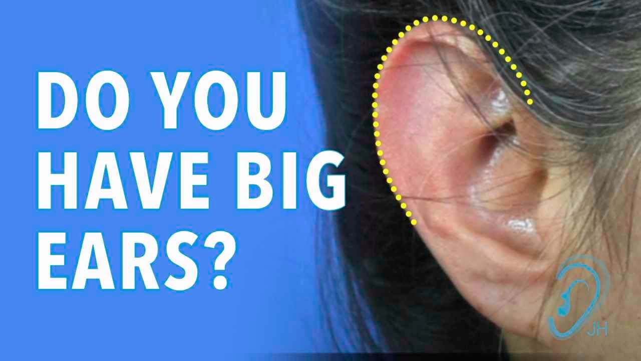 Do You Have Excessively Big Ears?