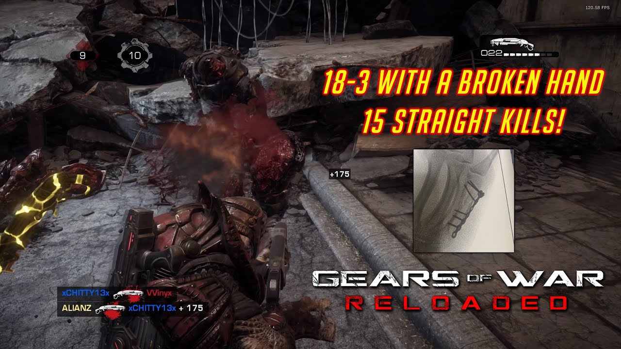 Gears of War: Reloaded | 18-3 with a broken hand - 15 STRAIGHT KILLS!