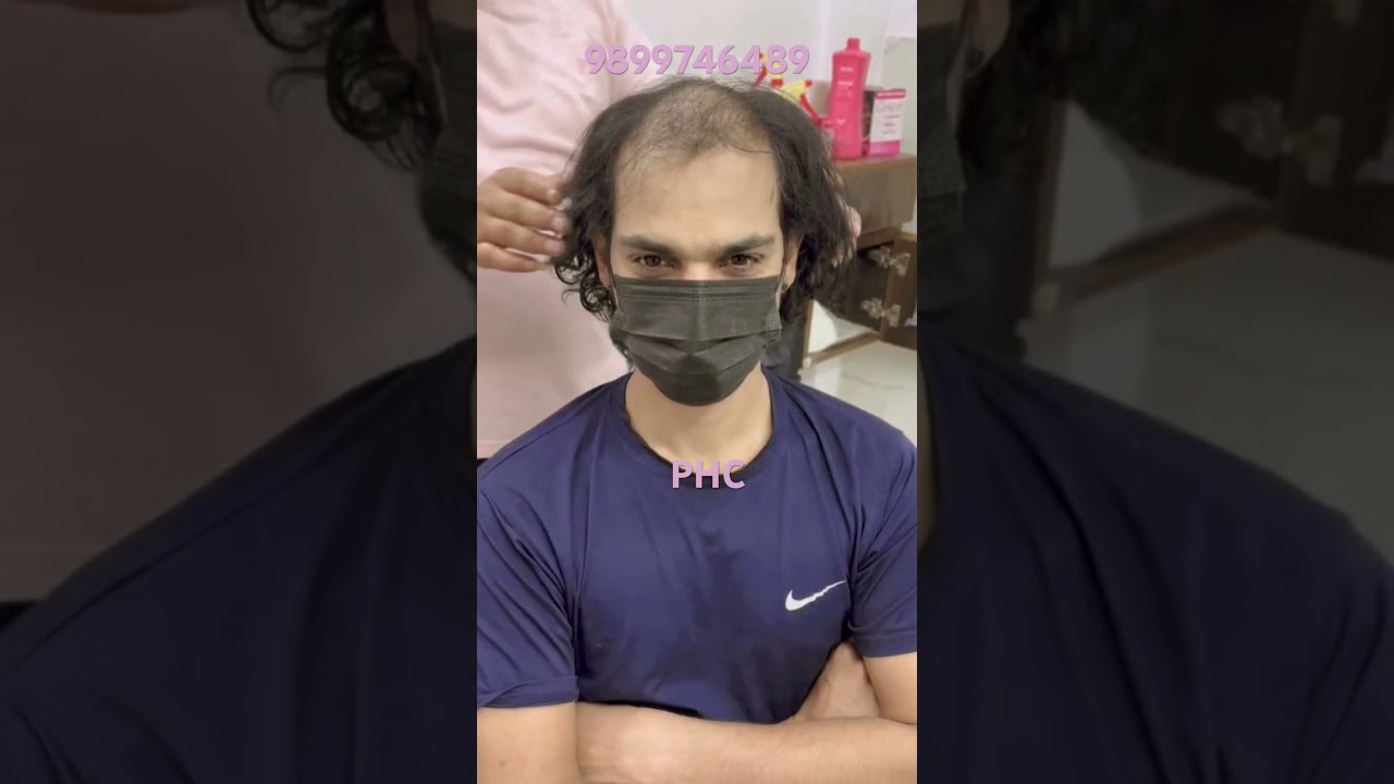 Long hair patches for men | long hair patch price ☎️ 8375845551 | #shorts #hairstyle #beauty #patch
