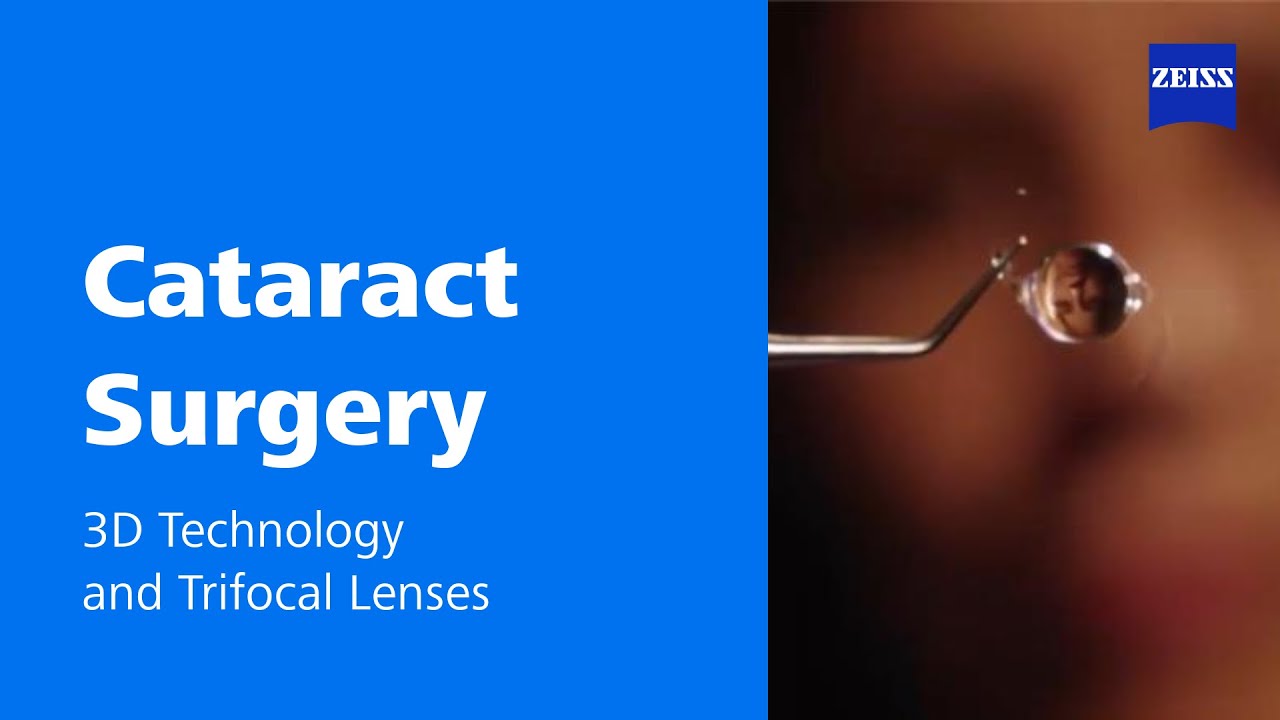 3D and trifocality &ndash; adding dimensions to your practice