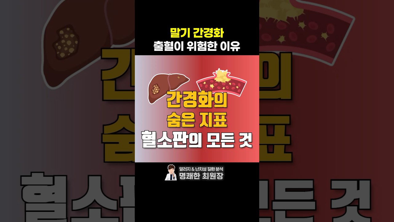 말기 간경화 혈소판 수치가 중요한 이유 (ft. 간암 발병률)