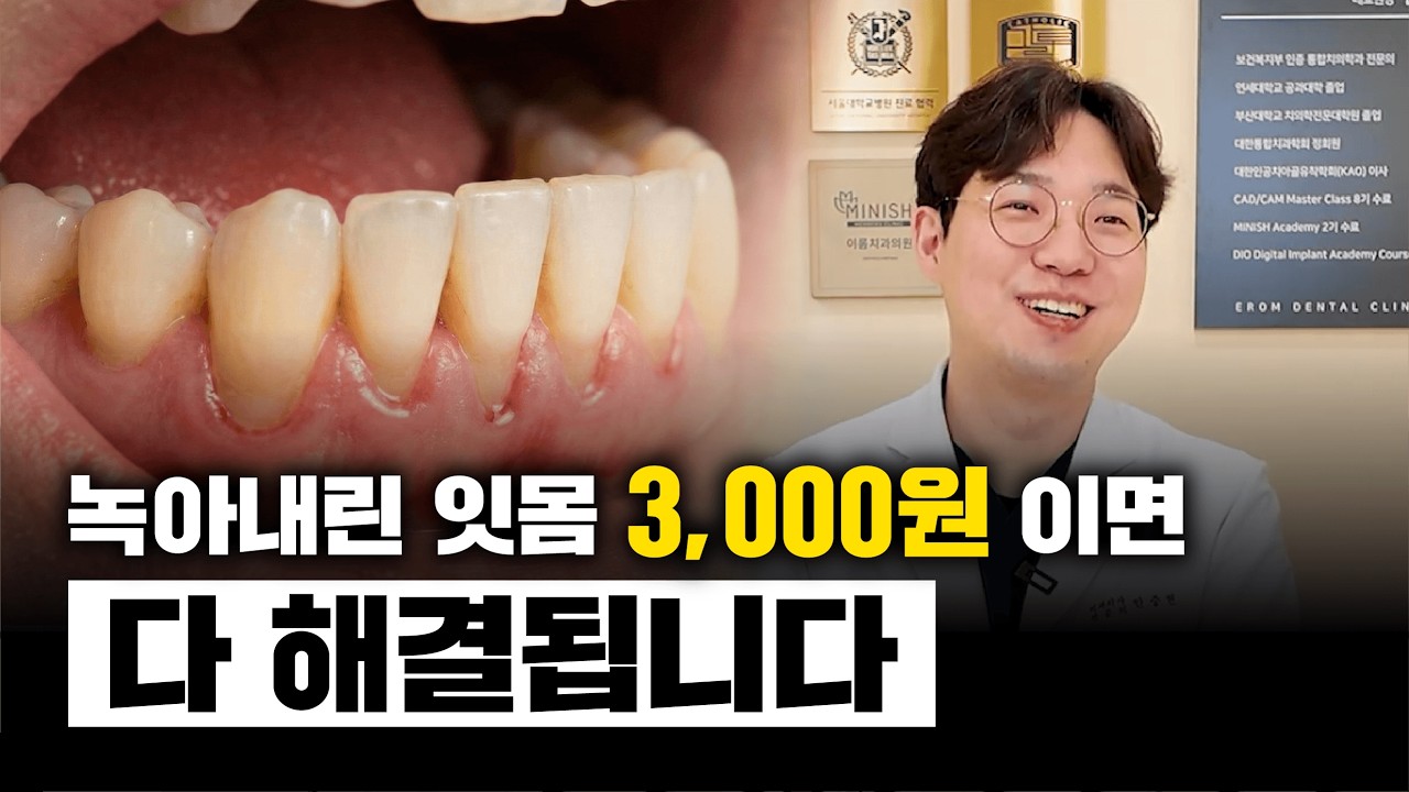 이거 알려주면 치과 망할지도 모릅니다