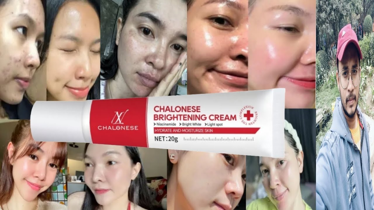 Chalonese Brightening Cream | Honest Review