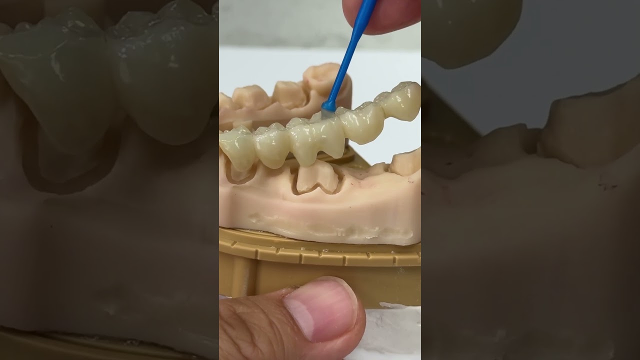 Amazing fits with 3 teeth! @EnvisiontecMain #envisiontec